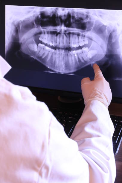 Best Emergency Dental Care for Abscessed Tooth in Desert Palms, CA